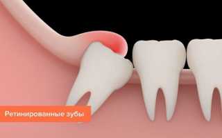 Какие бывают зубные болезни: все виды патологий от кариеса до поражения эмали