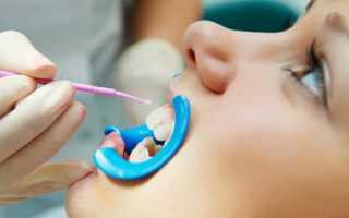 Паста для чувствительных зубов: рейтинг лучших лечебных