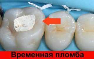 Почему болит зуб после пломбирования каналов, должен ли и сколько проходит боль