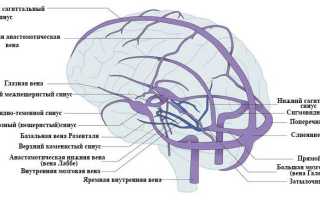 Тромбоз сосудов головного мозга: венозный, артериальный и синус тромбоз