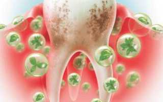 Заболевания зубов и полости рта: основные виды и их профилактика