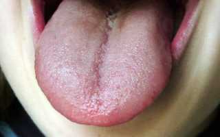 От чего может появиться неприятный запах изо рта: обзор главных причин