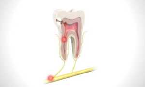 Виды основных стоматологических симптомов: как определить проблему в полости рта