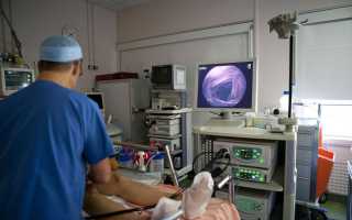 Аноскопия и ректороманоскопия кишечника