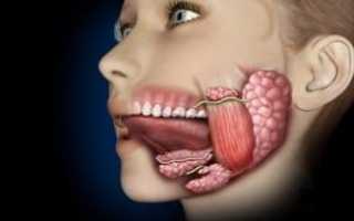 Абсцесс десны на нижней челюсти из-за зуба мудрости: что делать